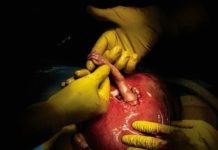 34 фото, которые потрясли весь мир