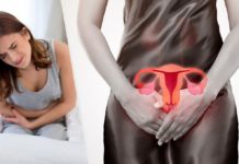 Все, что нужно знать про миому матки Все, что нужно знать про миому матки