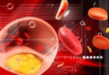 Чем опасен высокий холестерин? Чем опасен высокий холестерин?