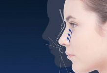 Ринопластика носа у доктора Бабаяна Гайка Павловича Ринопластика носа у доктора Бабаяна Гайка Павловича